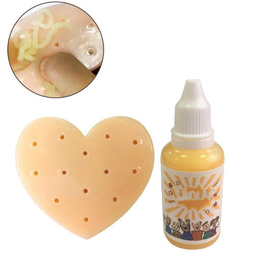 Pimple Popping Squeeze Toy